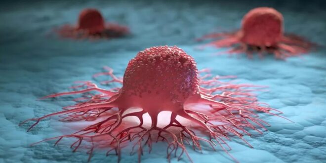 علماء يكتشفون سبب سرطان الرئة في مراحله المبكرة