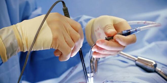 لأول مرة في تاريخ الطب البشري.. جراحة قلب دون شق الصدر